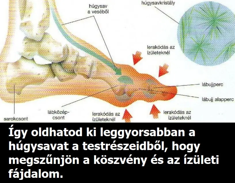 koszveny